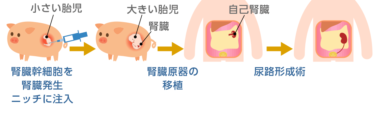胎生臓器ニッチ法
