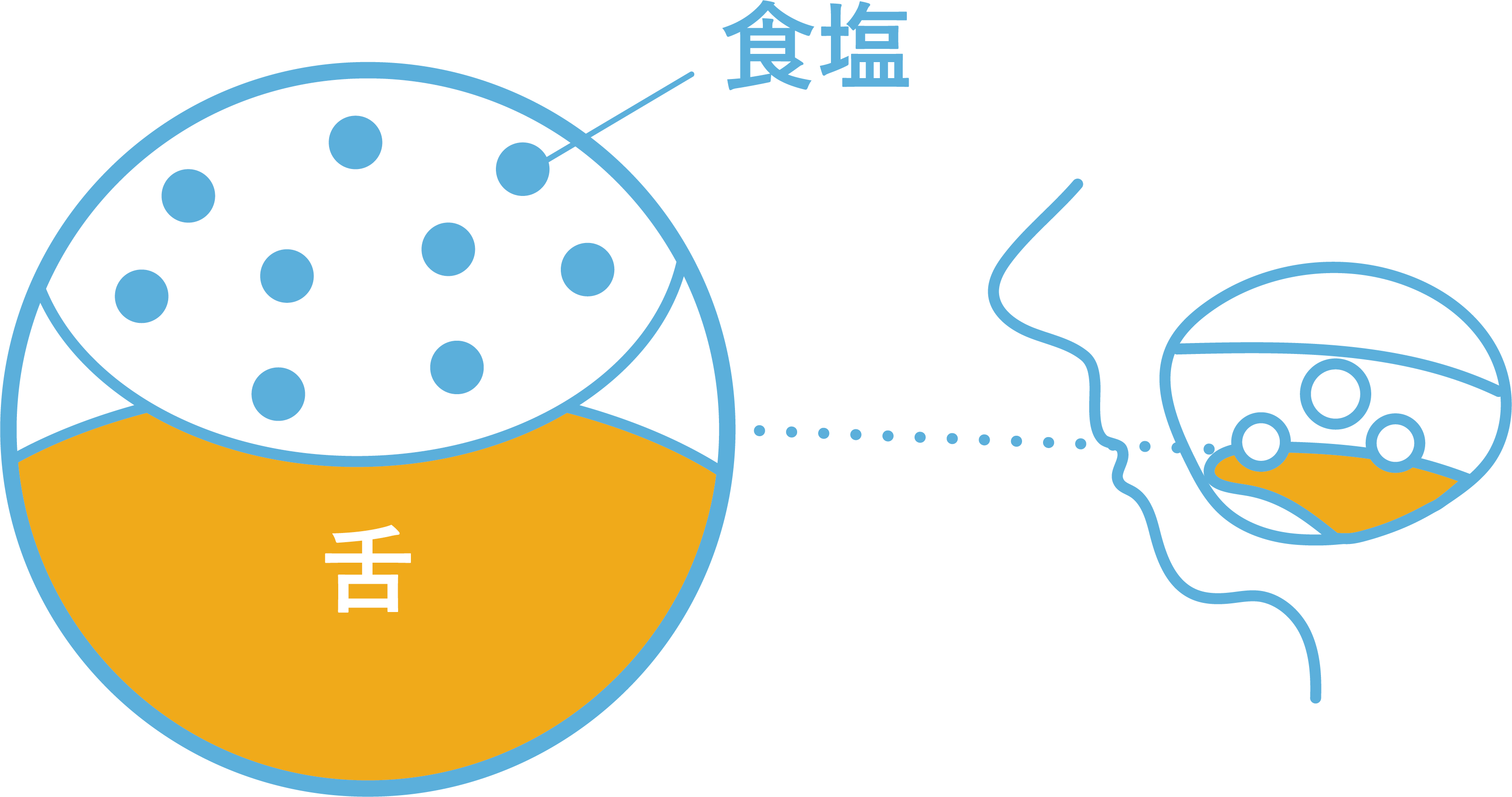 腎臓病 透析患者さんも無理なく減塩食を楽しめる 口内で塩分を後付けする減塩新技術 ソルトチップ 腎臓病 透析に関わるすべての人の幸せのための じんラボ