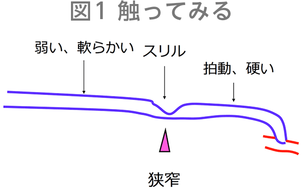 図1　触ってみる