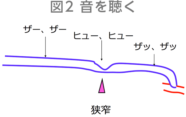 図2　音を聴く