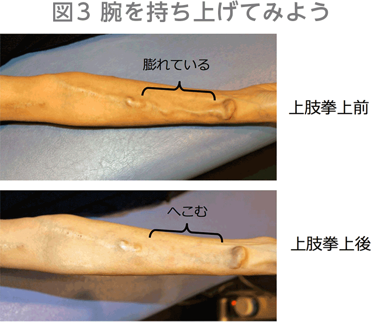 図3　腕を持ち上げてみよう