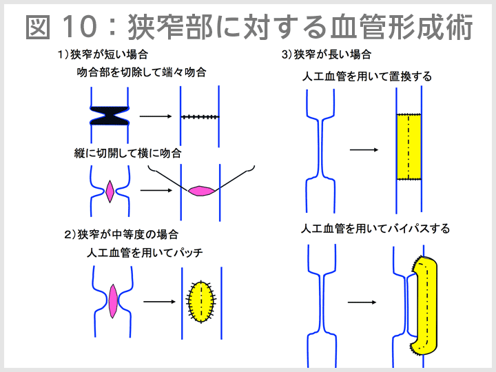 図10
