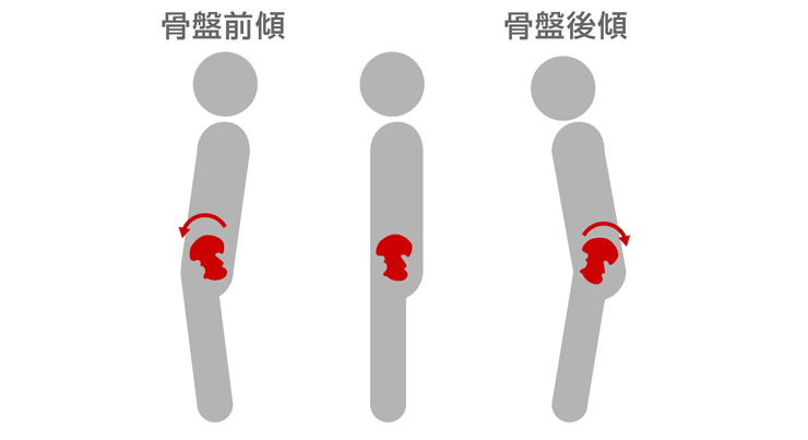 図4：骨盤前傾と骨盤後傾