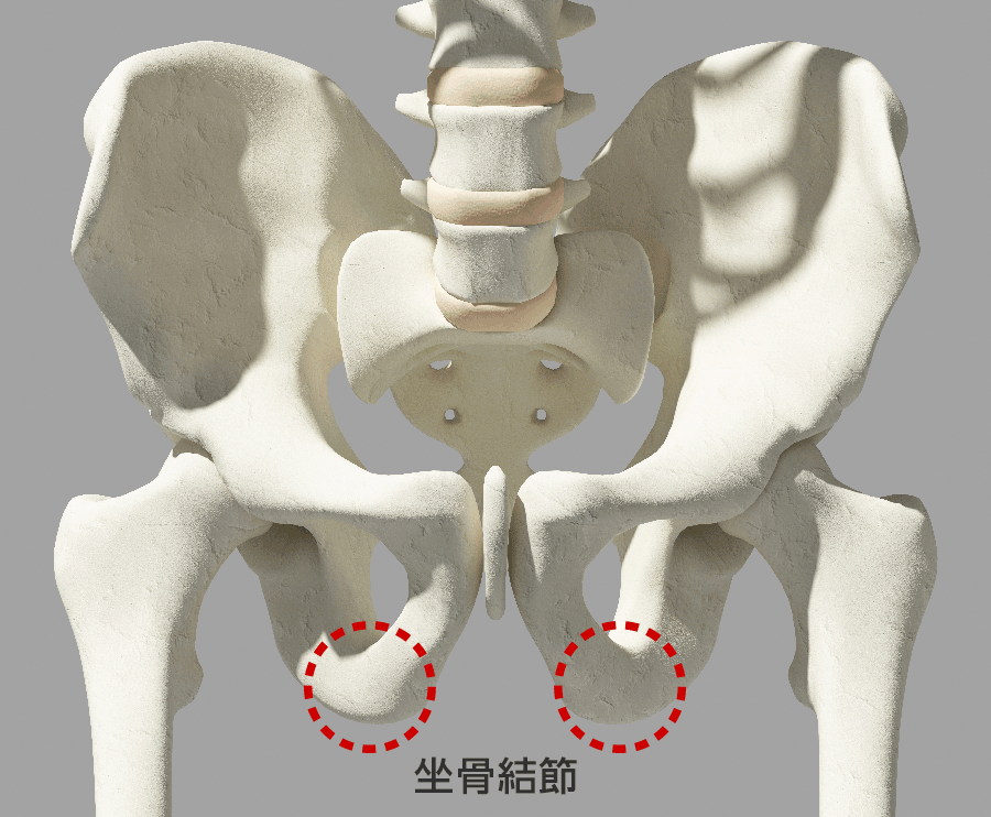 図6：坐骨結節