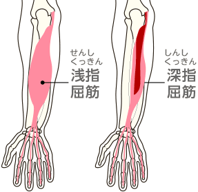 弾発指1