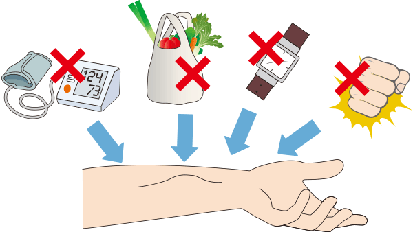 シャントは大切な相棒 日常生活での守り方 腎臓病 透析に関わるすべての人の幸せのための じんラボ