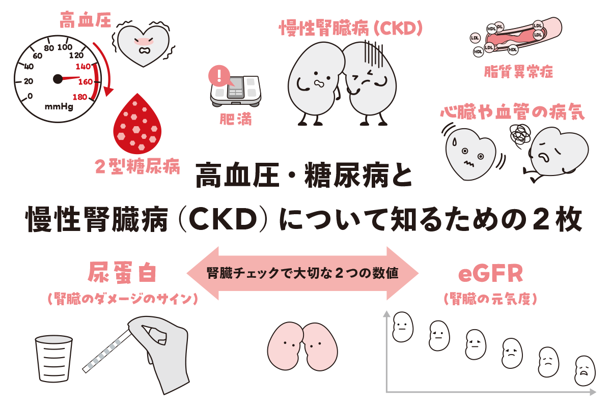 2026年3月12日に公開したCKDシートのビジュアル